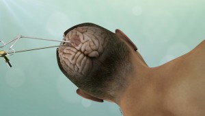Brain Tumor Support Groups photo picture Brain Tumor Support Groups