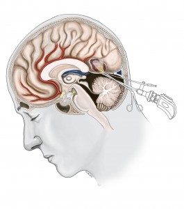 2019 year - Brain Tumor Support Groups 2019 year