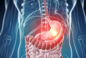 Symptoms related to the stomach and lower gut.