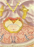 Trigeminal Neuralgia figure 1