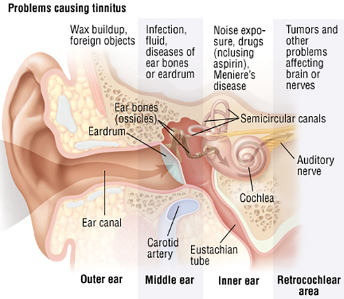Problems causing tinnitus.
