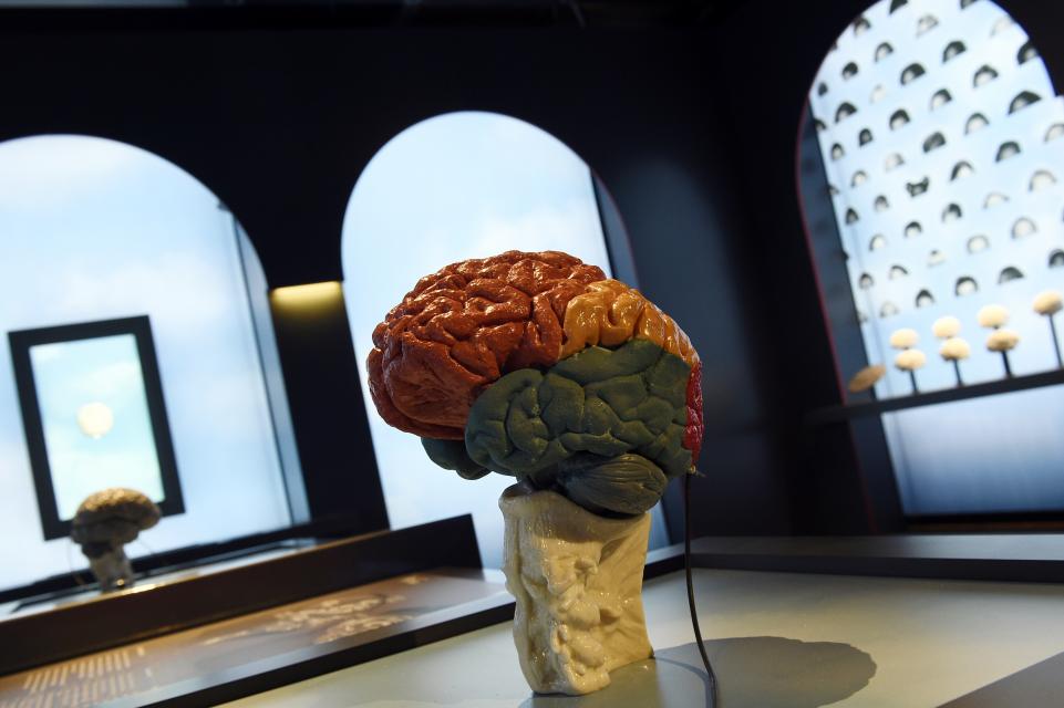 alzheimer brain