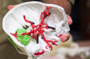 3D printed brain