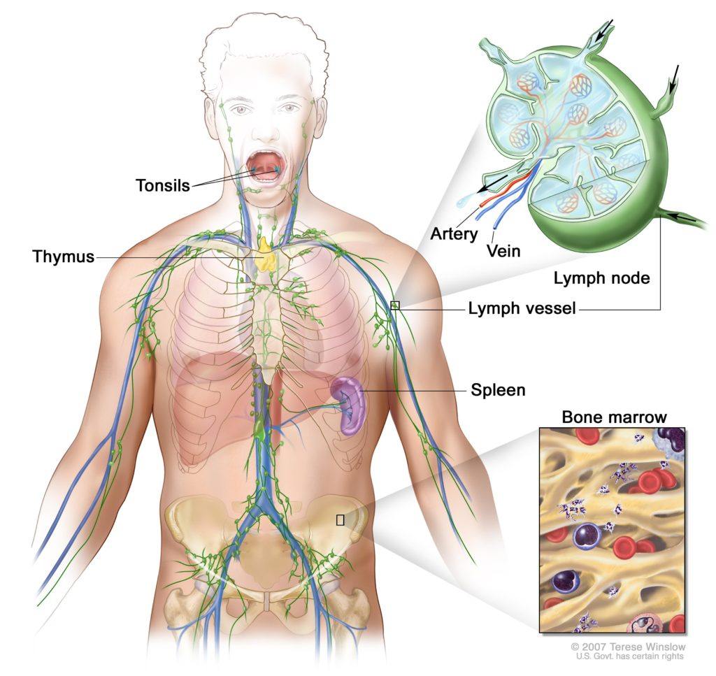 Central nervous system (CNS) lymphoma occurs when malignant cells form in the lymph tissue of the brain and/or spinal cord.
