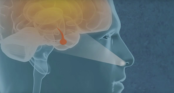 ENDONASAL-ENDOSCOPIC-SURGERY-VIDEO