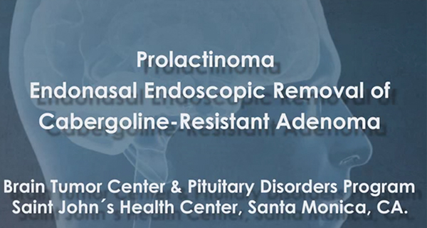 Endonasal Endoscopic Prolactinoma Surgery