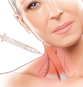 Cervical Dystonia Injection Treatment
