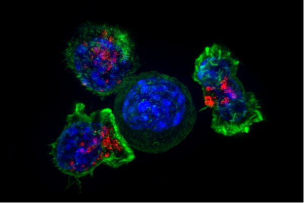 Second cancers deadlier in young patients