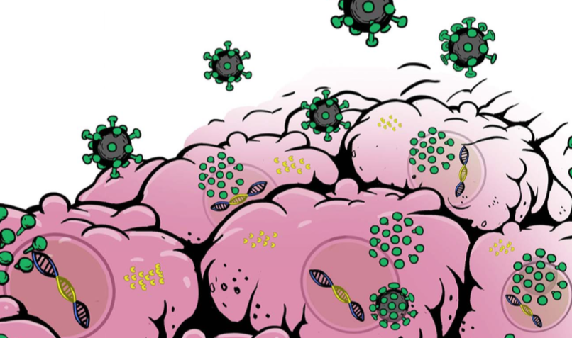 Tag team attack on glioma