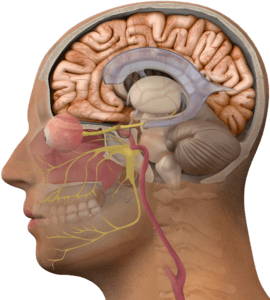 brain tumor