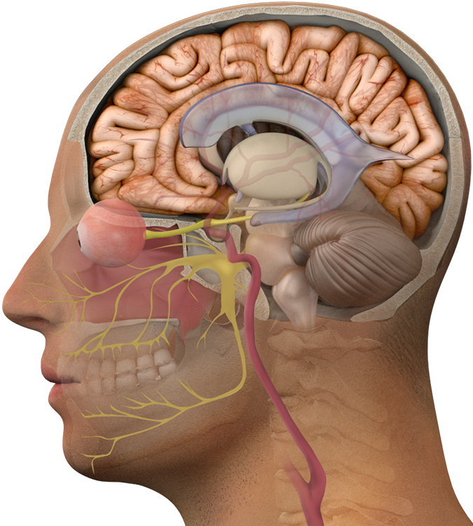 brain tumor