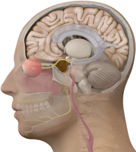 pituitary tumor