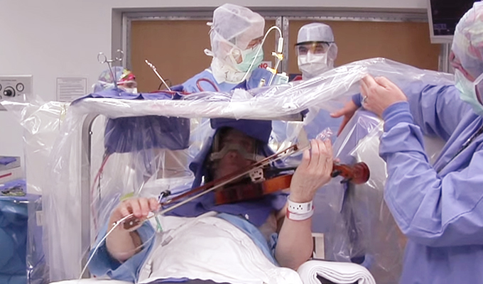 Principles and Practice of Keyhole Brain Surgery