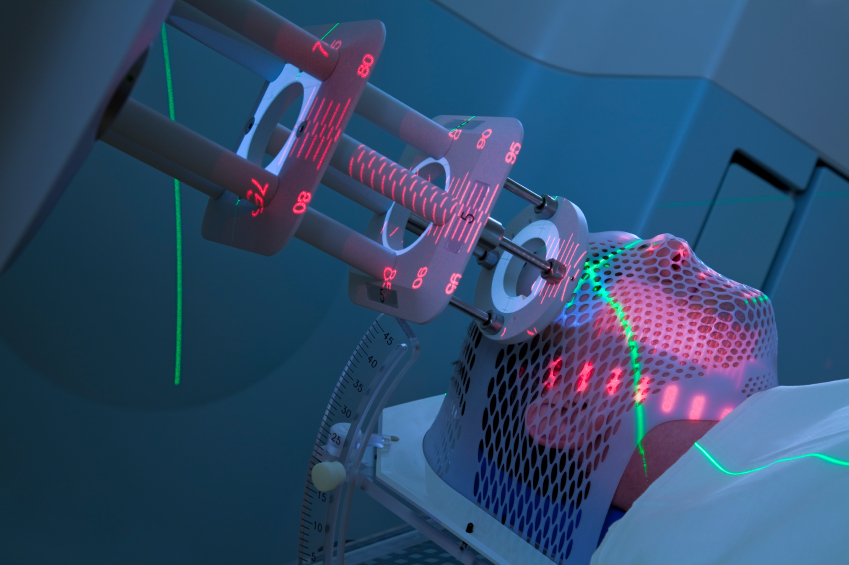 radiation-treatment