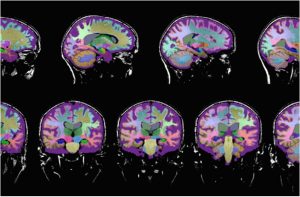 NeuroreaderTM