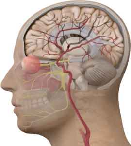stroke