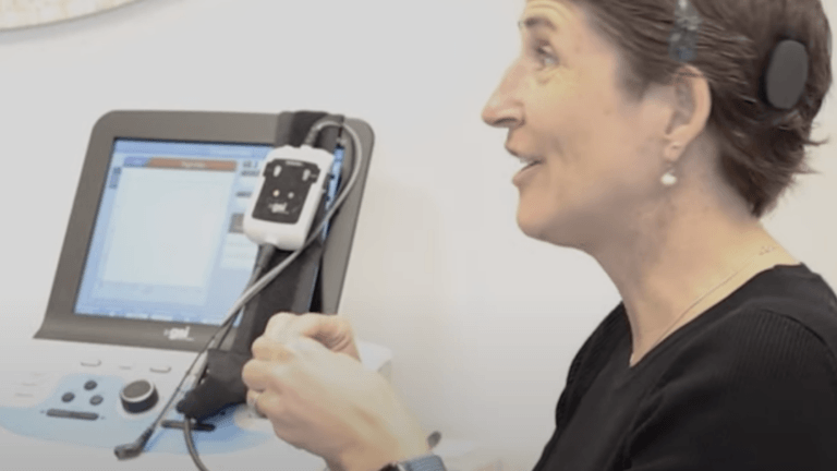 bilateral cochlear implants