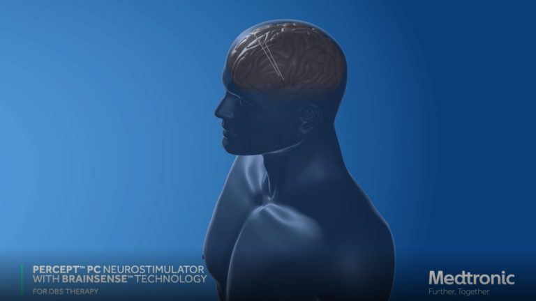 Percept™ PC with BrainSense™ technology DBS system