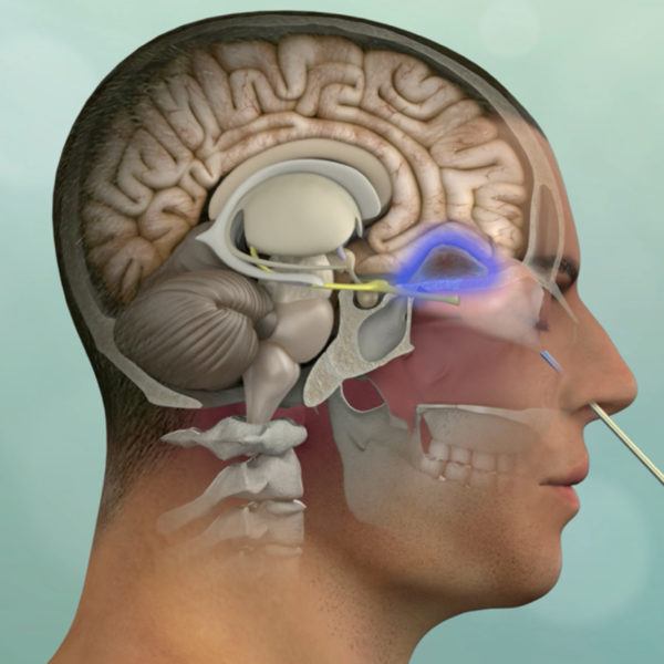 illustration of a endoscopic procedure