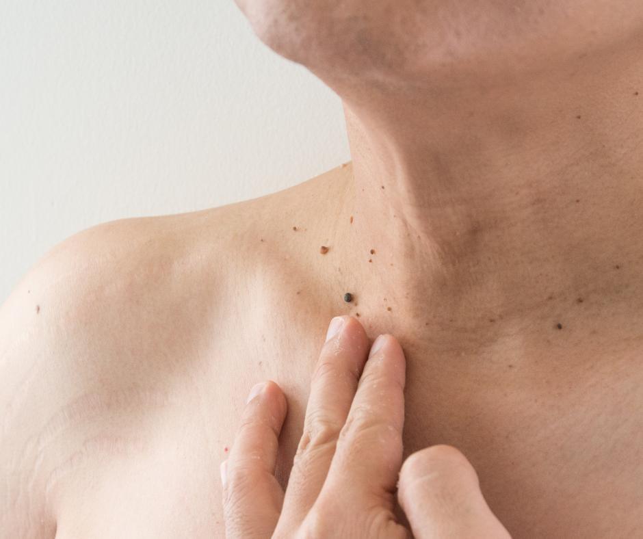 Persona touching mole on neck