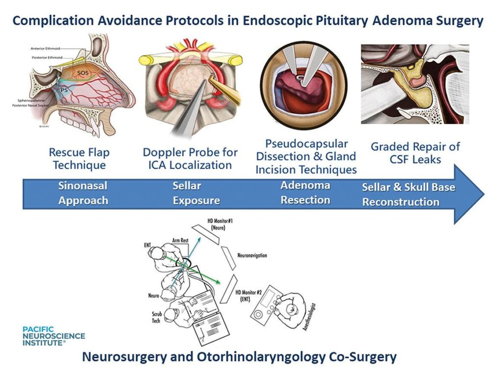 Pituitary Adenoma Timeline Figure