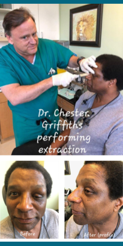 Dr. Chester Griffiths and patient