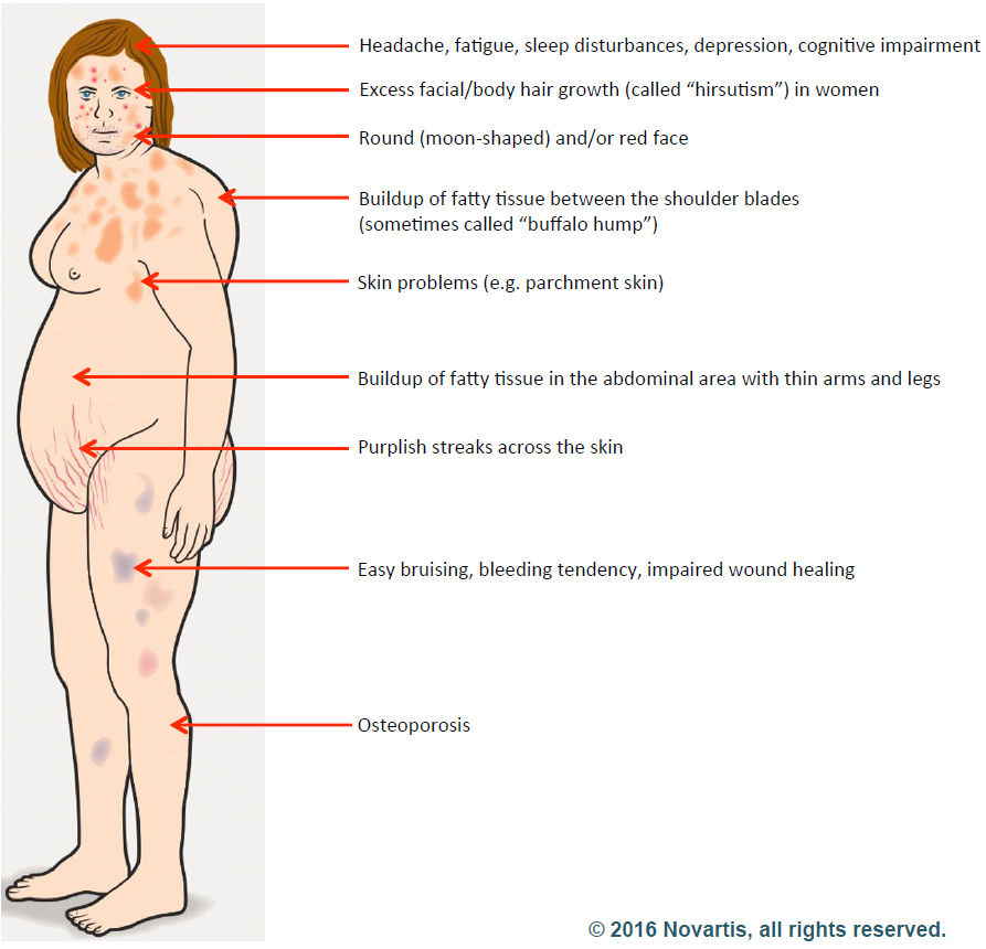 Cushings Disease_Novartis