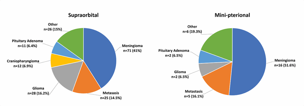 types of brain tumors infographi