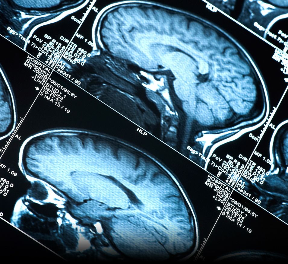 brain scans