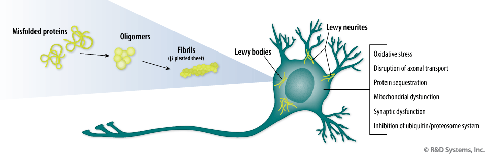 misfolded alpha-synuclein proteins