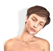 Cervical Dystonia diagnosis.