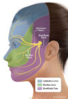 Facial Pain Syndromes and Trigeminal Neuralgia Treatment Guide ...