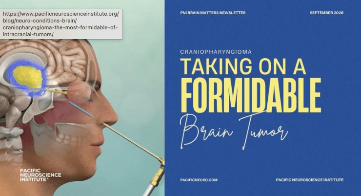 September 2026 brain health newsletter banner