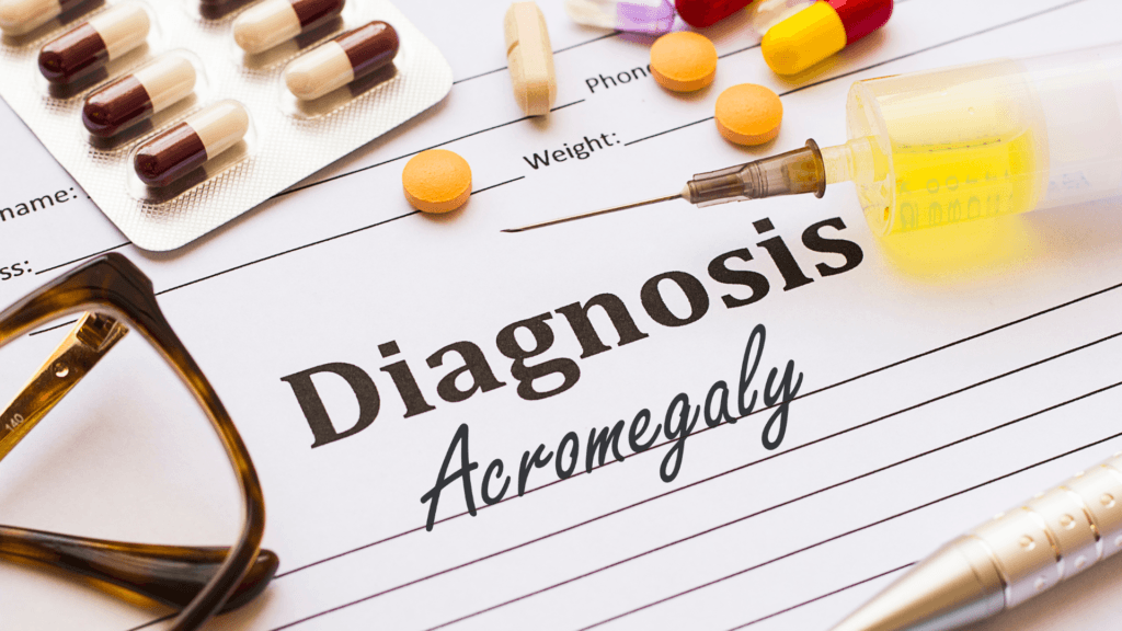 Acromegaly Awareness Day Pacific Neuroscience Institute