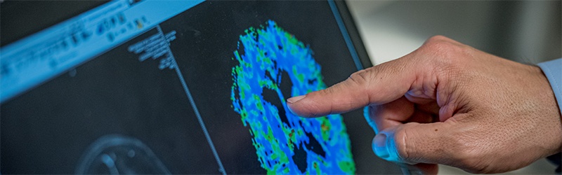 person pointing at a scan on a computer