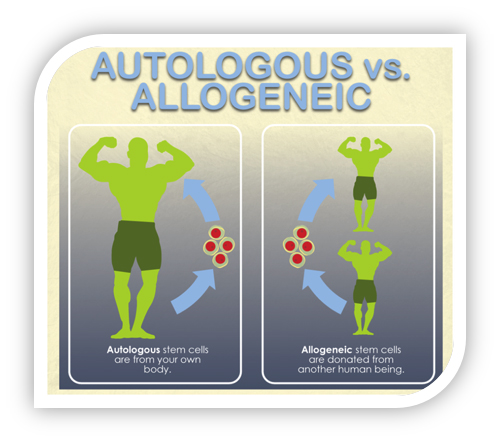 Autologous vs Allogenic stem cells