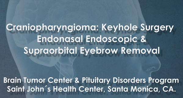 Craniopharyngioma- Keyhole and Endoscopic Endonasal Surgery