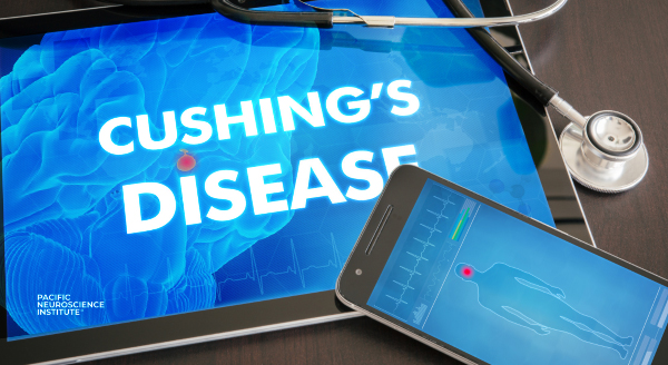 Cushing's disease 101