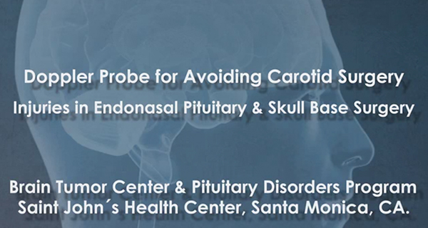 doppler probe banner