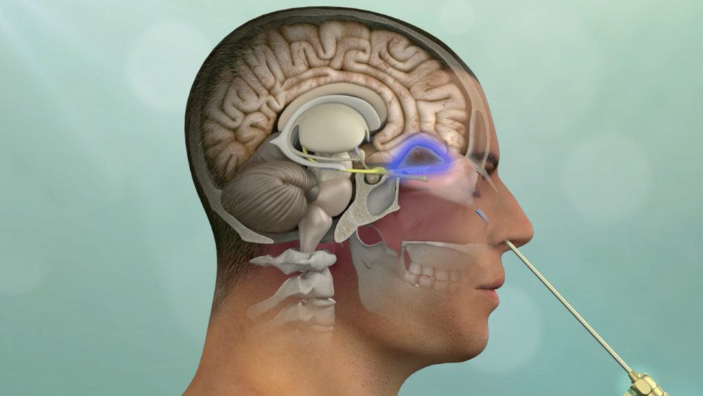 illustration of a endoscopic procedure