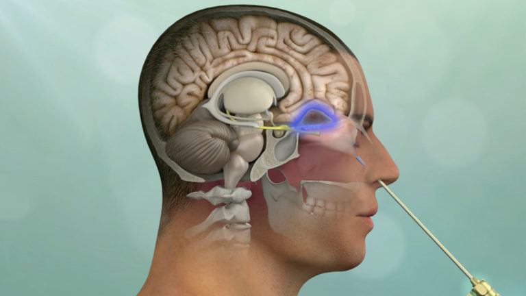 illustration of a endoscopic procedure