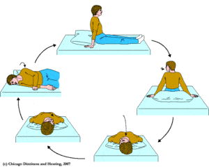 Epley and Semont maneuvers