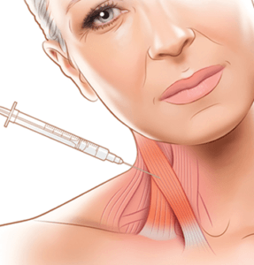 Cervical Dystonia Injection Treatment 