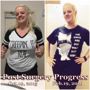 Jessica L Cushing's Disease