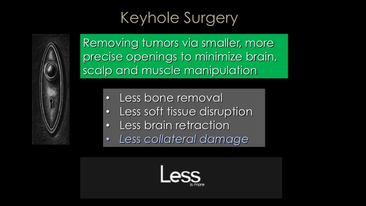Keyhole Meningioma Surgery