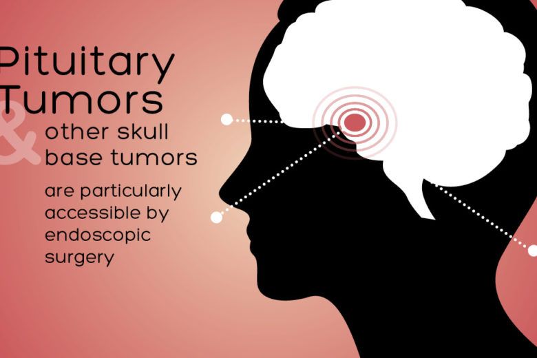 pituitary tumors banner