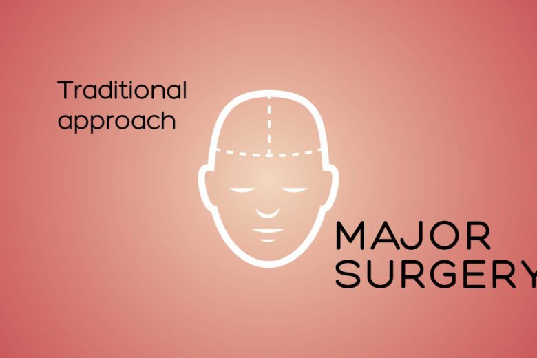major surgery banner