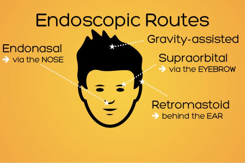 endoscopic routes banner