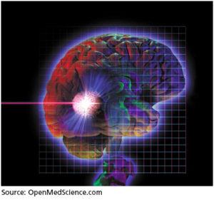 Radiosurgery