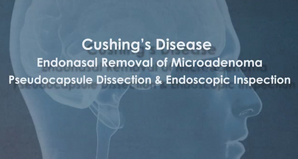 cushing's disease banner